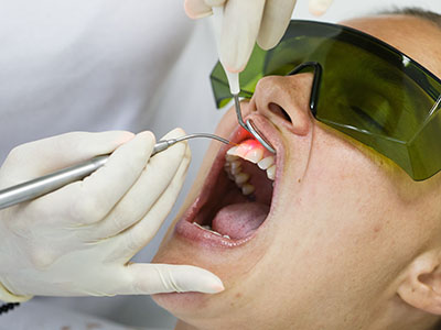 Steger Smiles | Sedation Dentistry, Digital Radiography and Veneers