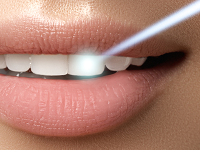 Steger Smiles | Fluoride Treatment, Snoring Appliances and Extractions